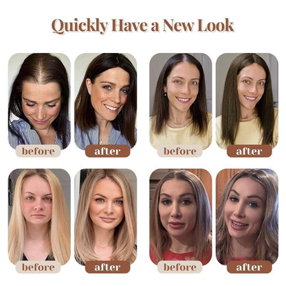 Hair Toppers for Women Real Human Hair 150% Density Clip In Topper Hairpieces 10 × 12CM Swiss Base Wiglet Top Hair Pieces for Women with Thinning Hair（12Inch,1B#）
